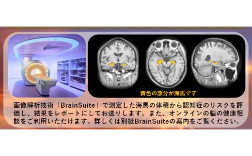 【贈り物にも】トワイライトドック?夕方からの脳の健康診断?